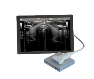 <span style="font-weight: normal;">Ультразвуковой сканер: MicrUs EXT-1H</span><br>