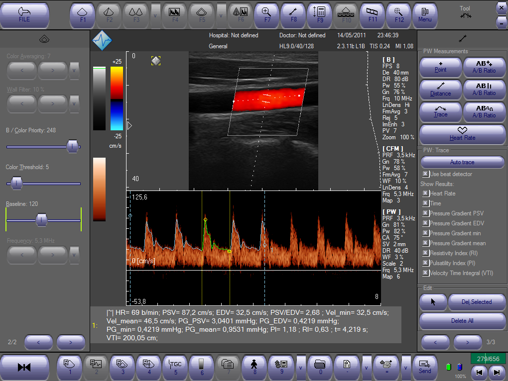 <span style="font-weight: normal;">Программное обеспечение. Галерея </span><br>